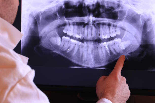 Best Weekend Emergency Dentist in Pacheco, CA