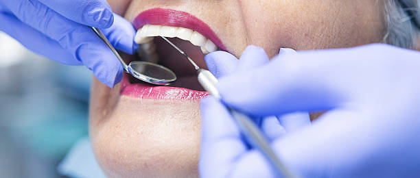 Best Emergency Dental Extractions in Pacheco, CA